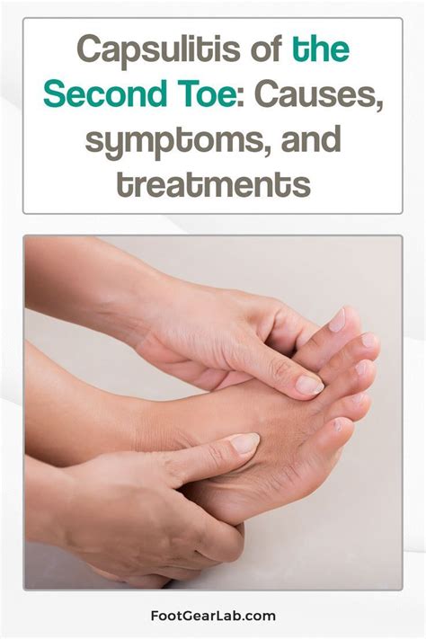 List of Common Treatments for Capsulitis of the Second Toe